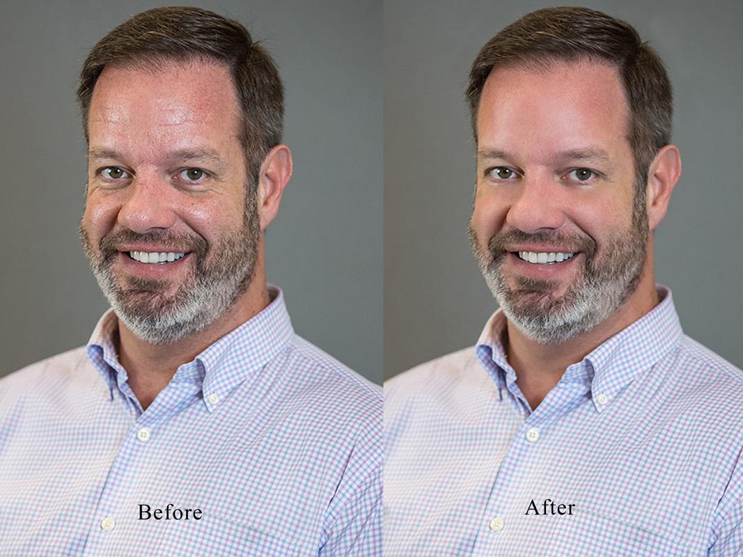 Retouching